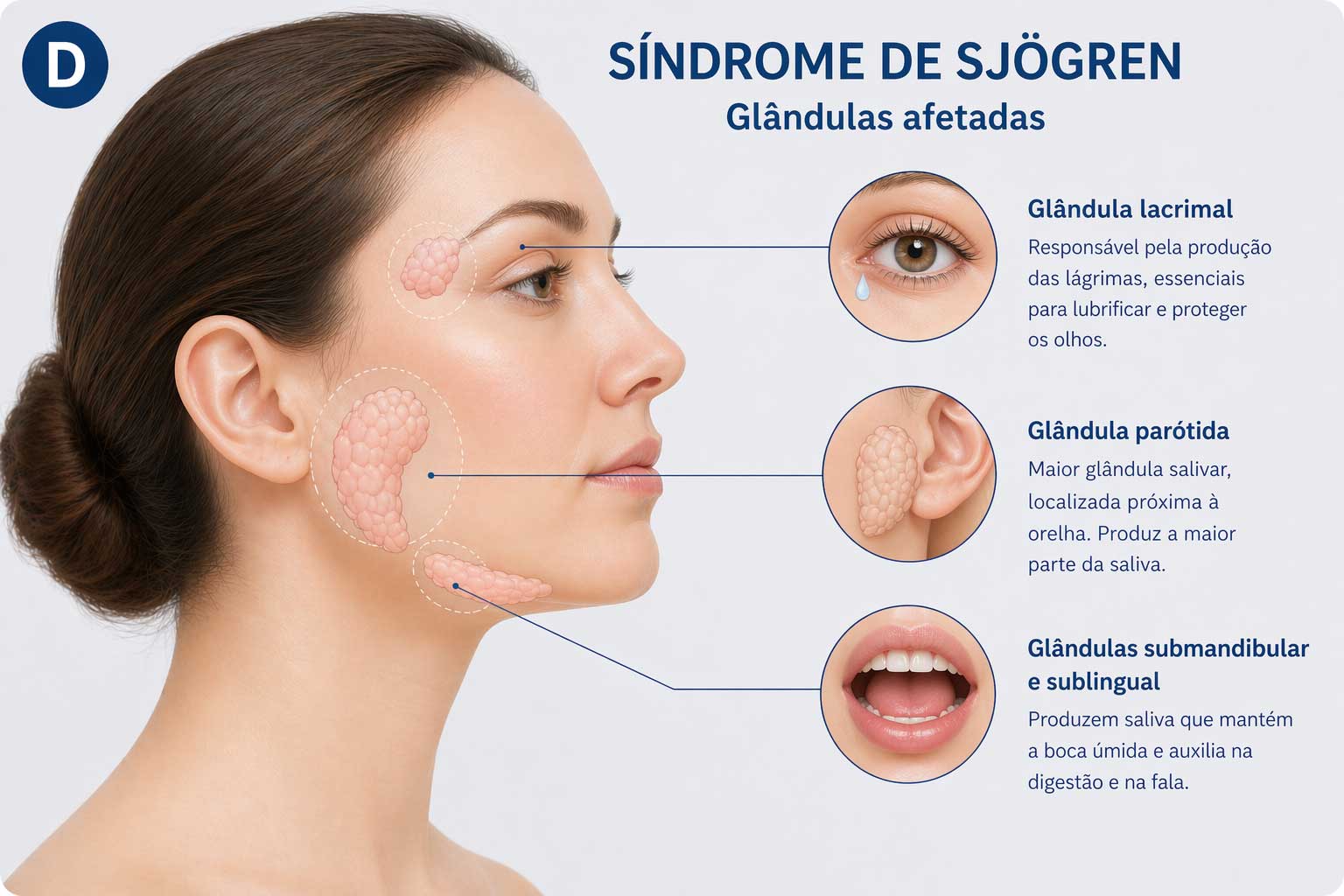 Sjogren01